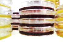 Bild von gestapelten Petrischalen